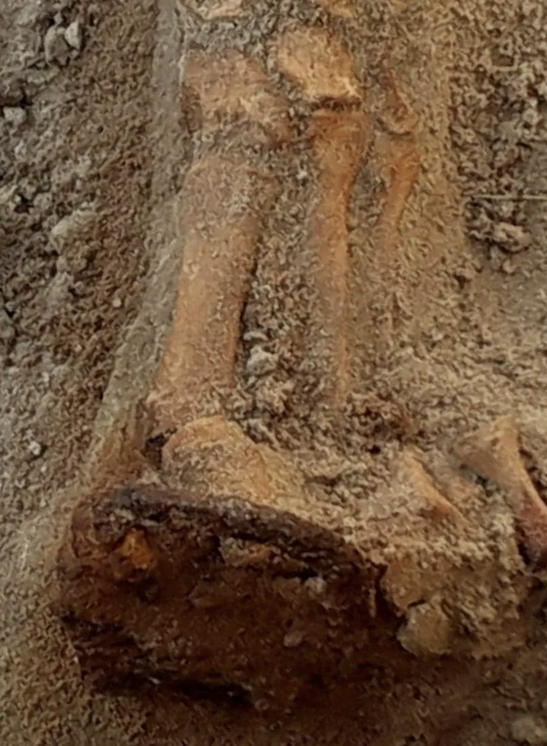 Remains of woman with a padlock attached to her big toe. 
